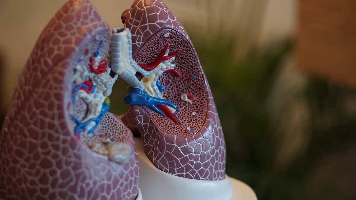 lungs lung cancer